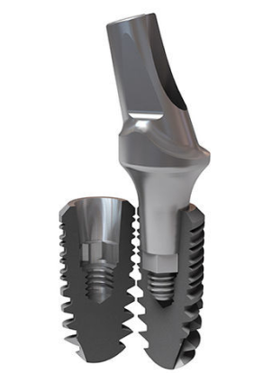 Implant TEKKA 