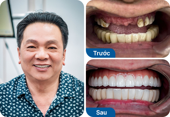 Mr. Thanh Tung