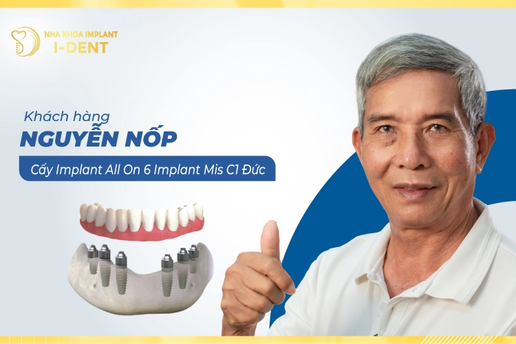 Thumb-nguyen nop