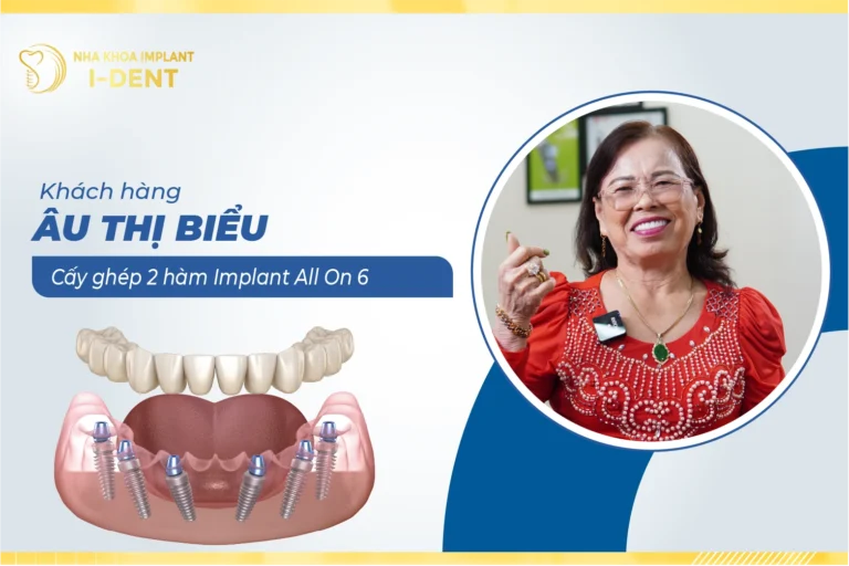 Au-Thi-Bieu-thumb