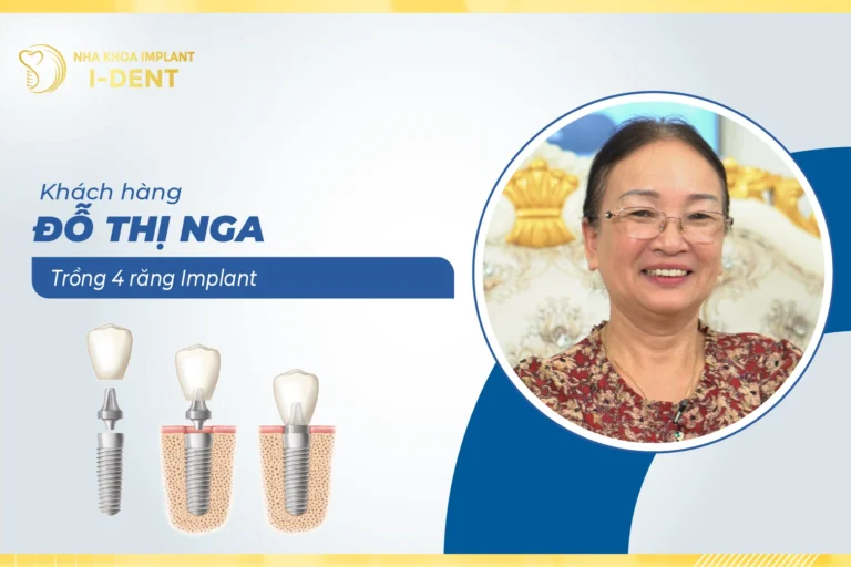 thumb-do-thi-nga