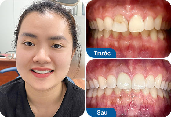 Ms. Thuy Duong