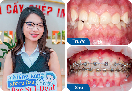 Chị Thanh Nhàn
