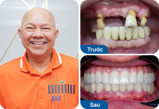 Chú Nguyễn Văn Huy