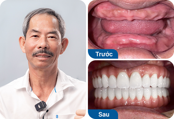 Chú Ngô Văn Út