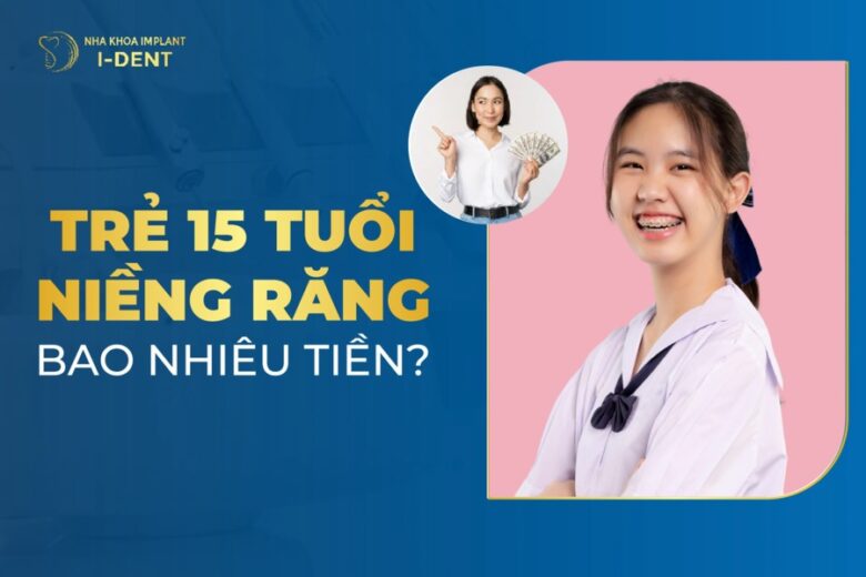 Trẻ 15 Tuổi Niềng Răng Bao Nhiêu Tiền? Bảng Giá 2025