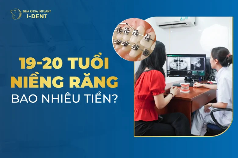 19 Tuổi Niềng Răng Bao Nhiêu Tiền? Thời Gian Điều Trị Mất Bao Lâu?