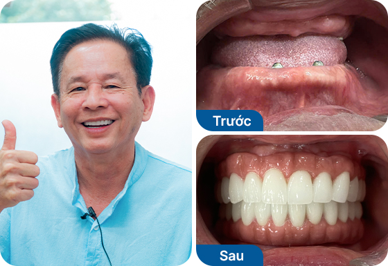 Chú Nguyễn Minh Hào