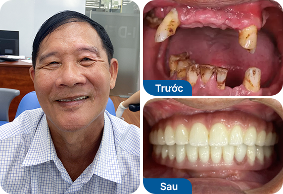 Chú Trần Hoàng Vũ