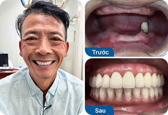 Mr.trung Do