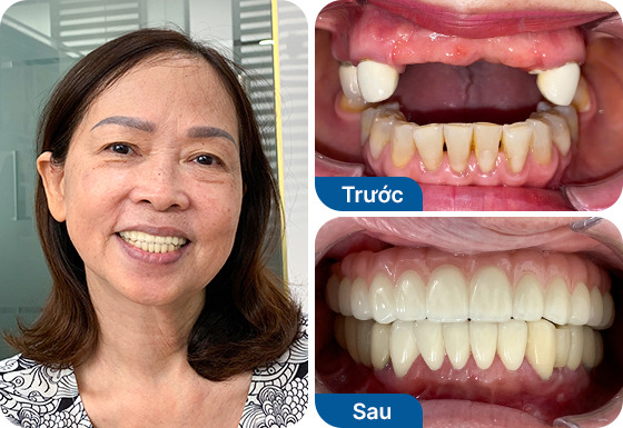 Ms. Phan Thuy Huyen