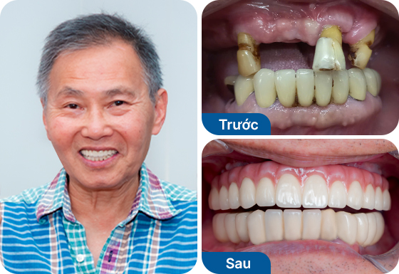 Chú Tony Cường Hoàng