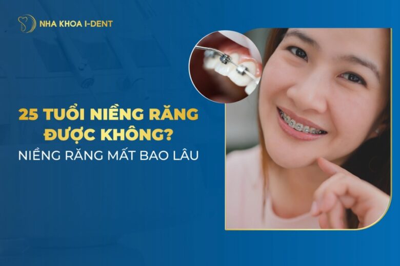 25 Tuổi Niềng Răng Được Không? Mất Bao Lâu?