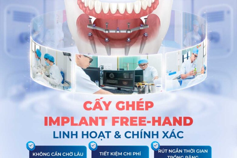 Trồng Răng Implant Toàn Hàm Với Kỹ Thuật Free Hand: Giải Pháp Linh Hoạt, Chính Xác