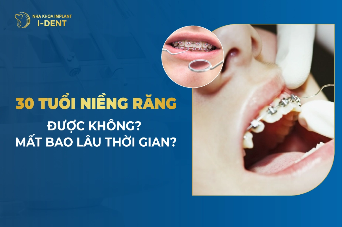 30 Tuoi Nieng Rang Duoc Khong Mat Bao Lau Thoi Gian