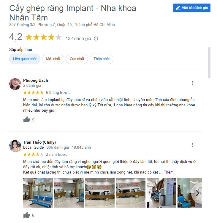cấy ghép răng implant ở đâu tốt