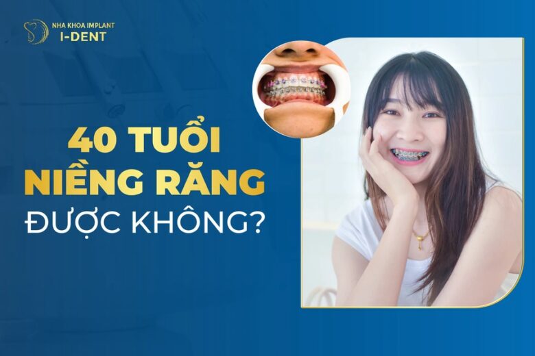40 Tuổi Niềng Răng Được Không? Có Lâu Không?