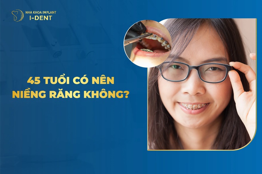 45 Tuoi Co Nen Nieng Rang