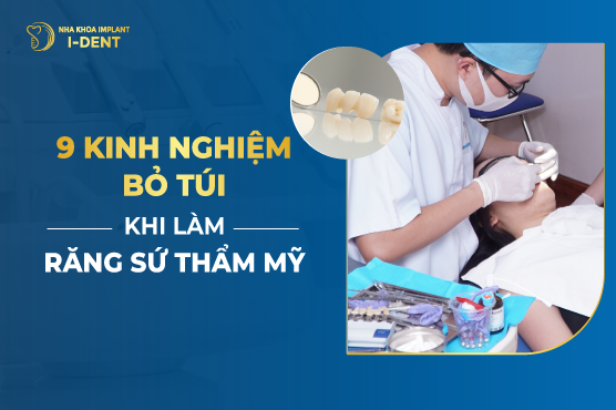 6 Kinh Nghiệm Bọc Răng Sứ Cần Bắm Để Kết Quả Tốt
