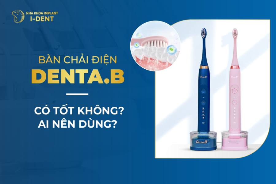 Ban Chai Dien Denta.b Co Tot Khong Thumb E1765772865912