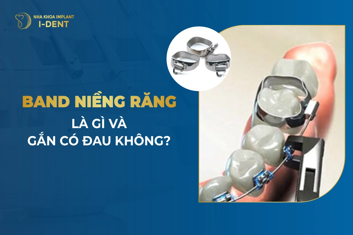 Band Nieng Rang La Gi Va Gan Co Dau Khong