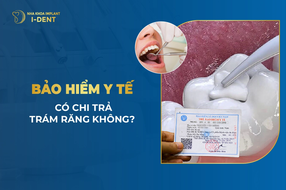 Bao Hiem Y Te Co Chi Tra Tram Rang Khong