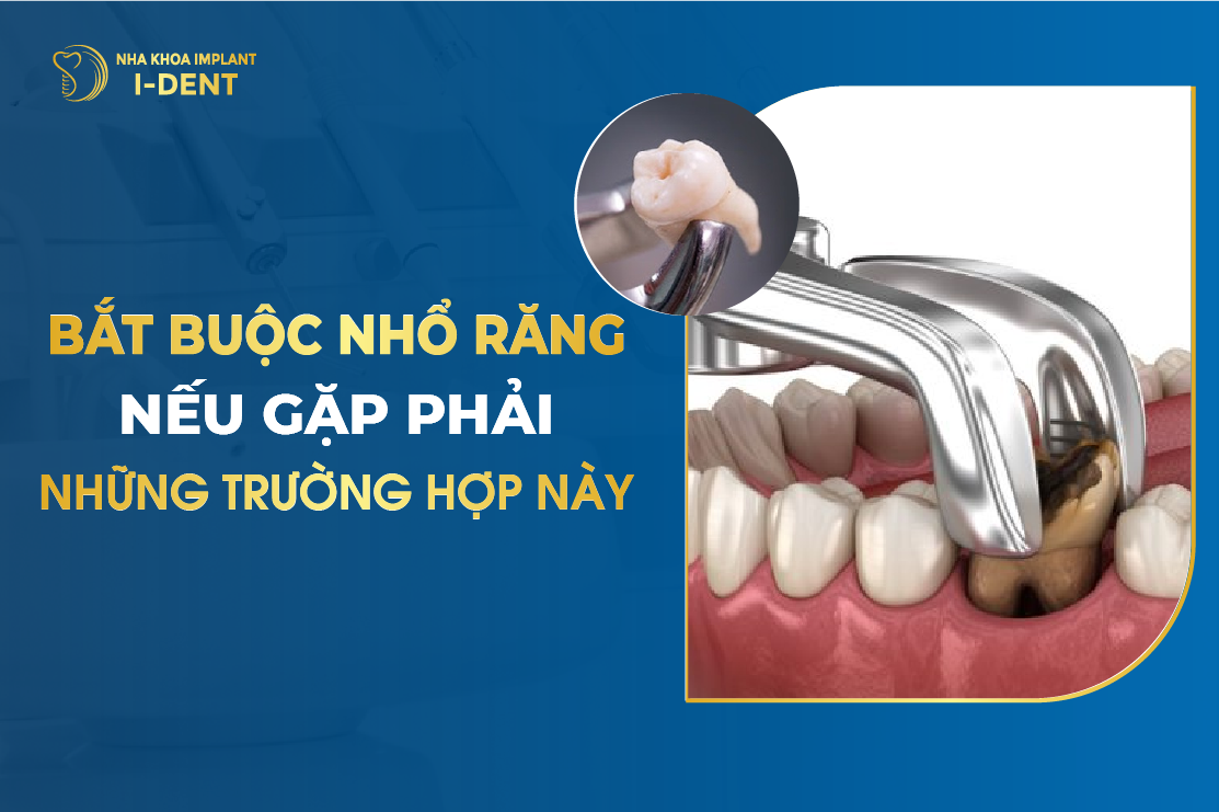 Bat Buoc Nho Rang Neu Gap Phai Nhung Truong Hop Nay