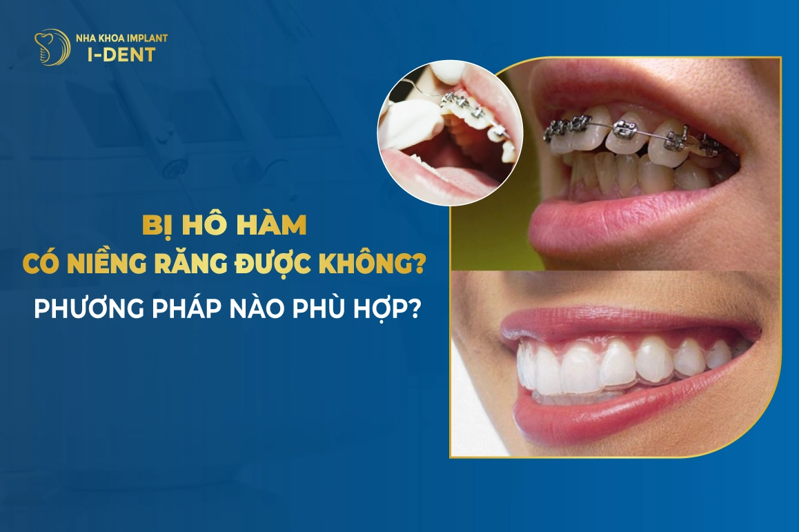 Bi Ho Ham Co Nieng Rang Duoc Khong Phuong Phap Nao Phu Hop