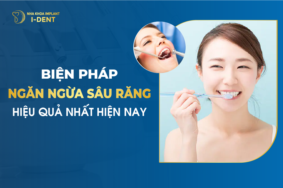 Bien Phap Ngan Ngua Sau Rang Hieu Qua Nhat Hien Nay