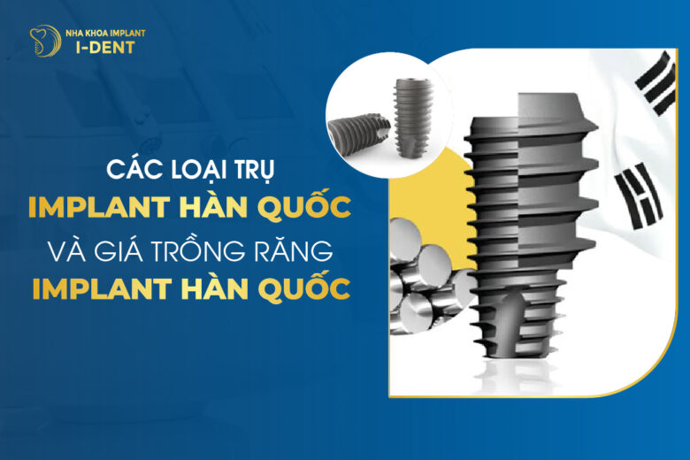 Trụ Implant Hàn Quốc: 8 Trụ Implant Tốt Nhất Và Giá