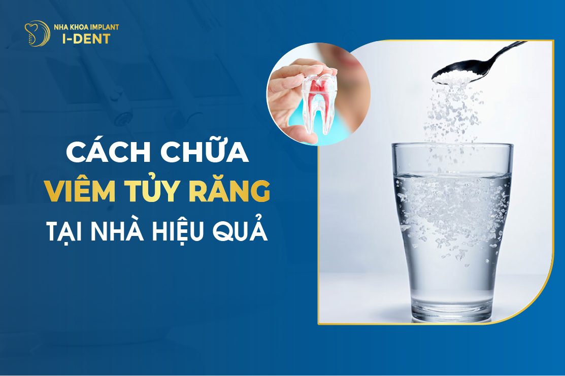 Cach Chua Viem Tuy Rang Tai Nha Hieu Qua
