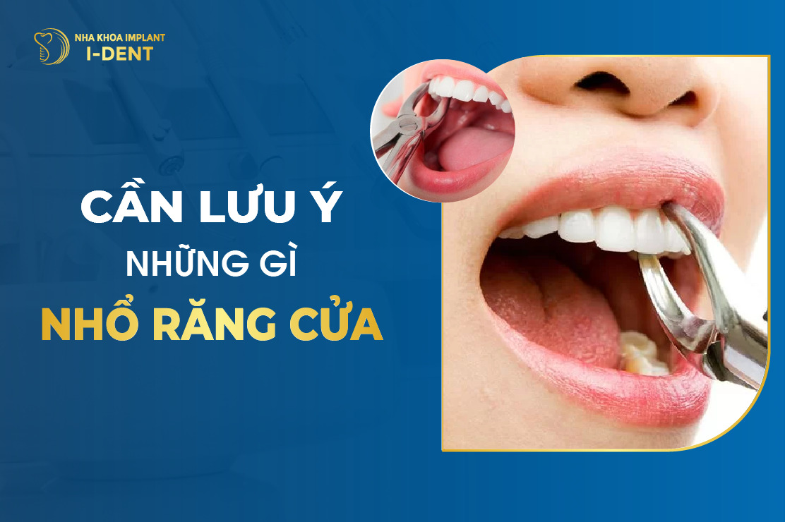 Can Luu Y Nhung Gi Khi Nho Rang Cua