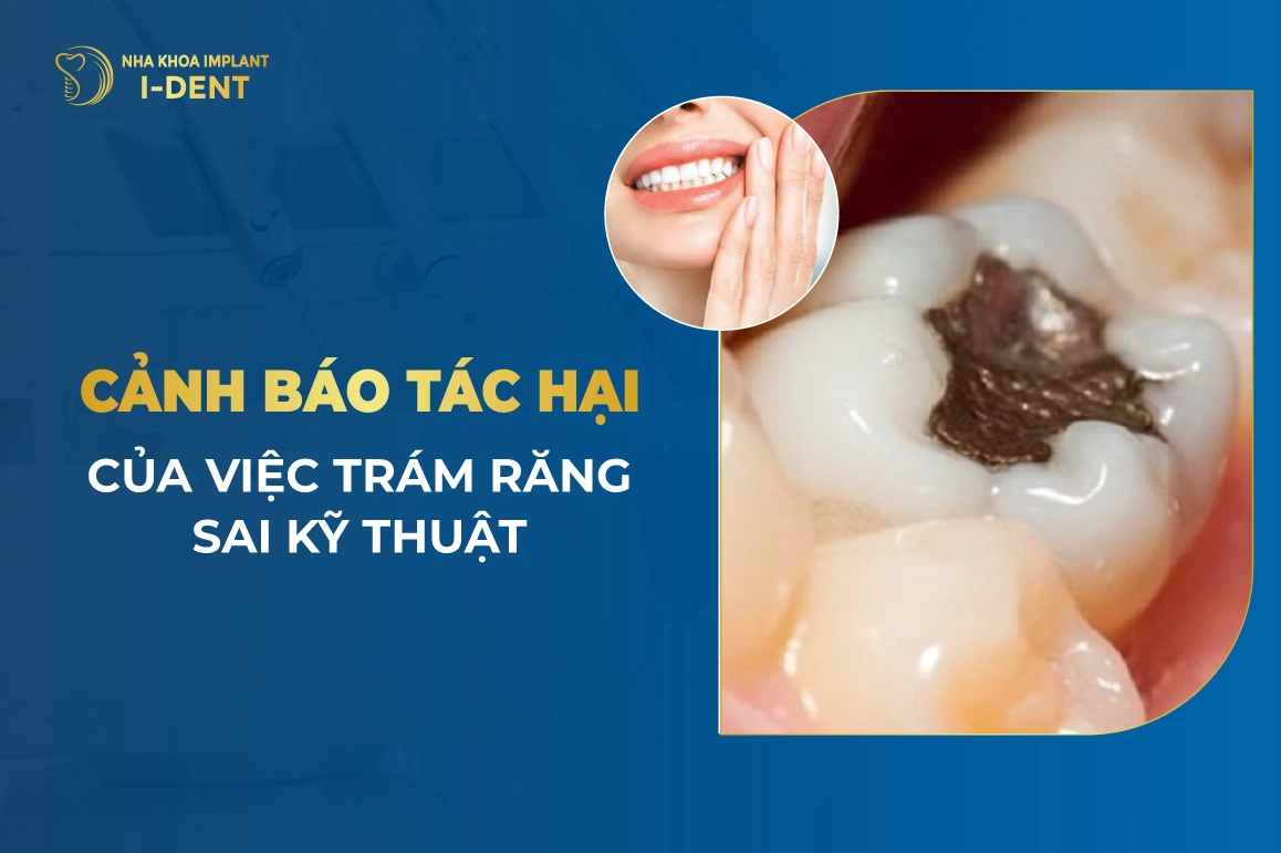 Canh Bao Tac Hai Cua Viec Tram Rang Sai Ky Thuat