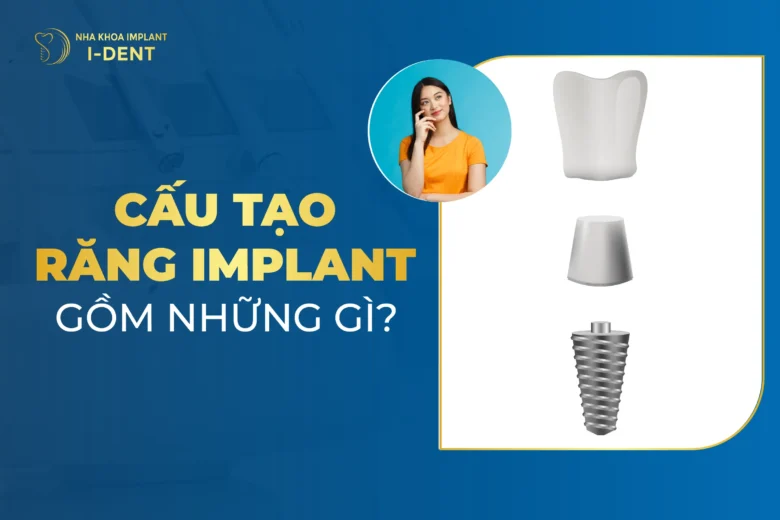 Cấu Tạo Răng Implant Gồm Những Gì?