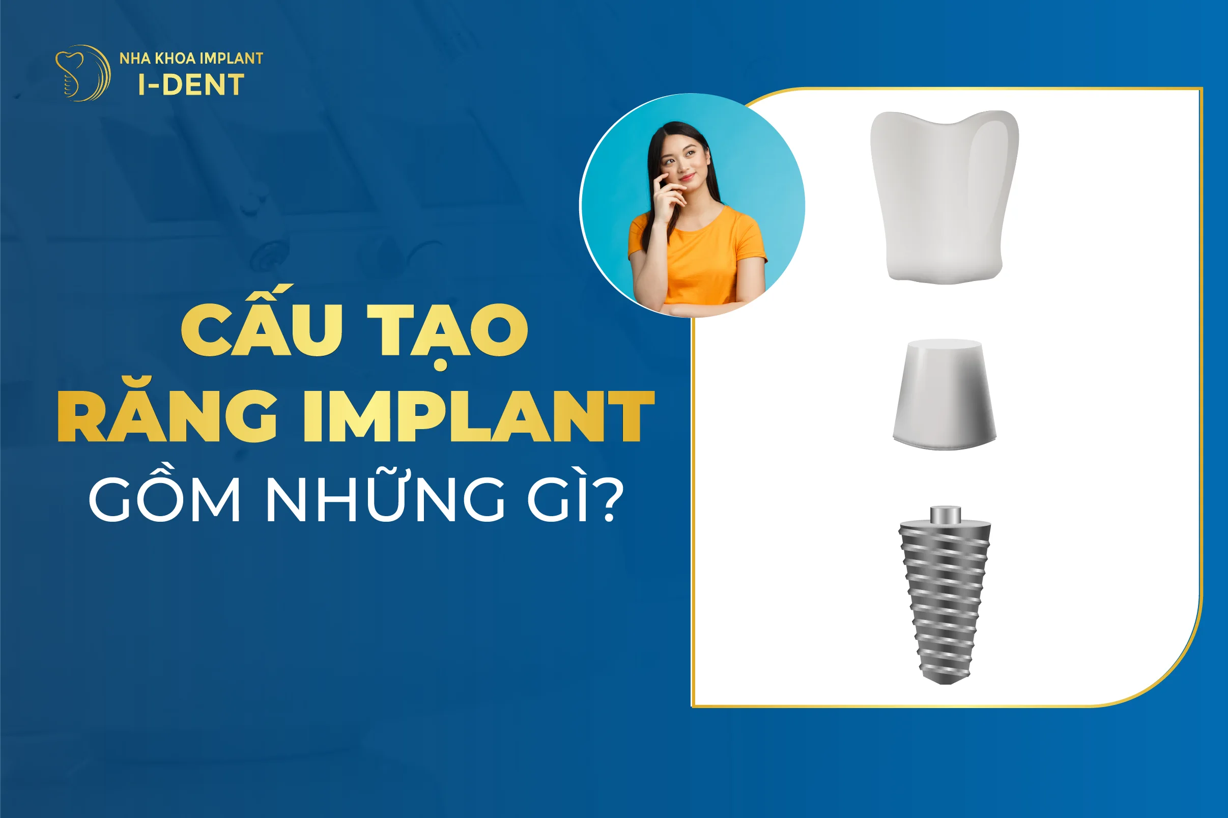 Cau Tao Rang Implant Gom Nhung Gi