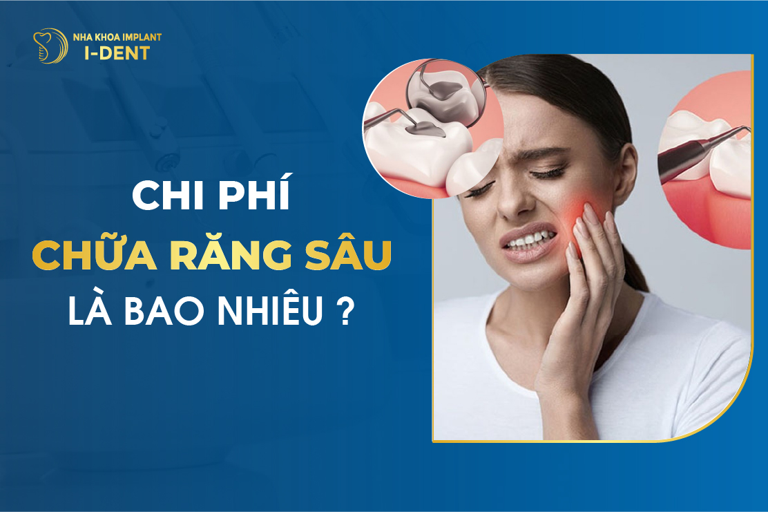 Chi Phi Chua Rang Sau La Bao Nhieu