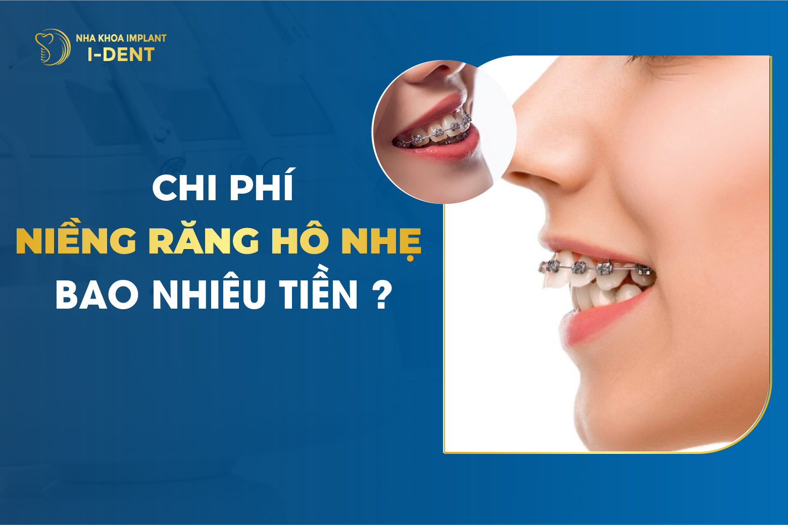 Chi Phi Nieng Ho Nhe Chi Phi Bao Nhieu