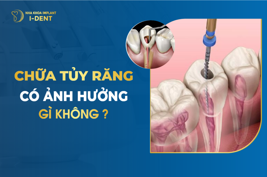 Chua Tuy Rang Co Anh Huong Gi Khong E1773115968183