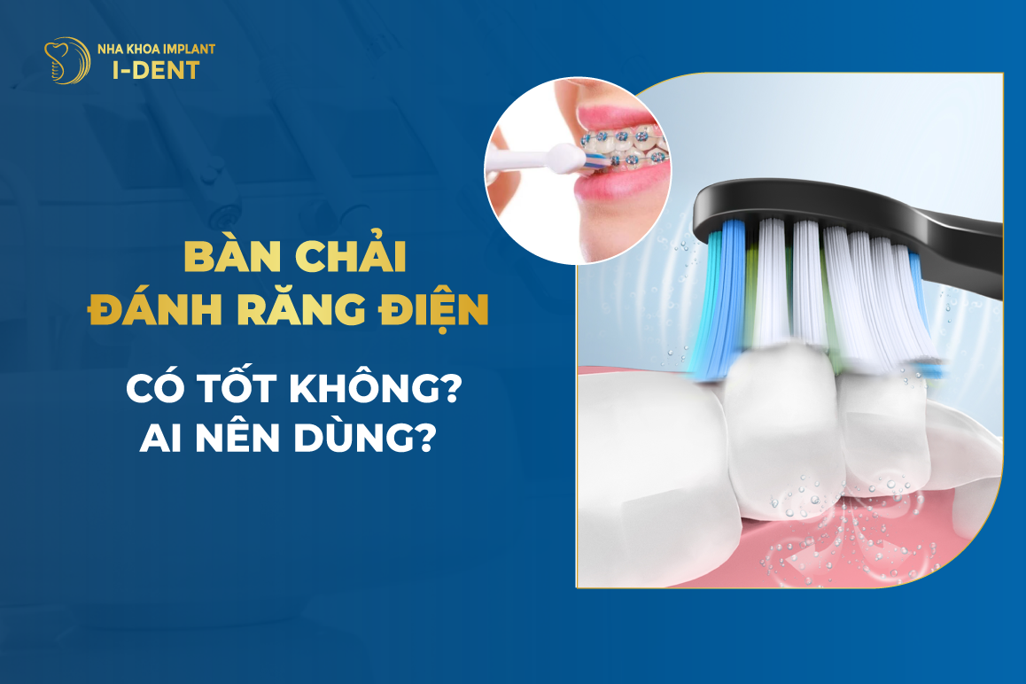 Co Nen Dung Ban Chai Danh Rang Dien Khong