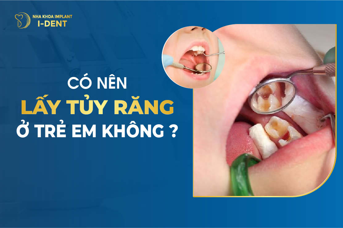 Co Nen Lay Tuy Rang O Tre Em Khong