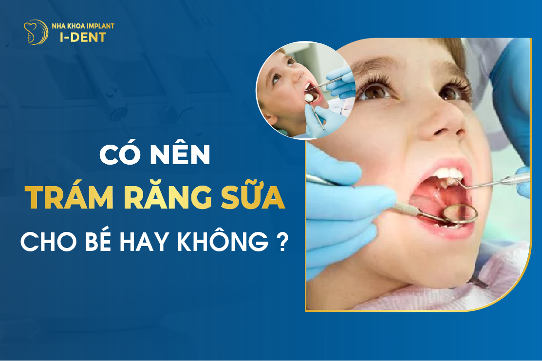 Co Nen Tram Rang Sua Cho Be Hay Khong