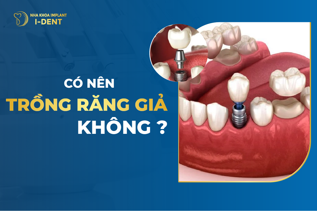Co Nen Trong Rang Gia Khong
