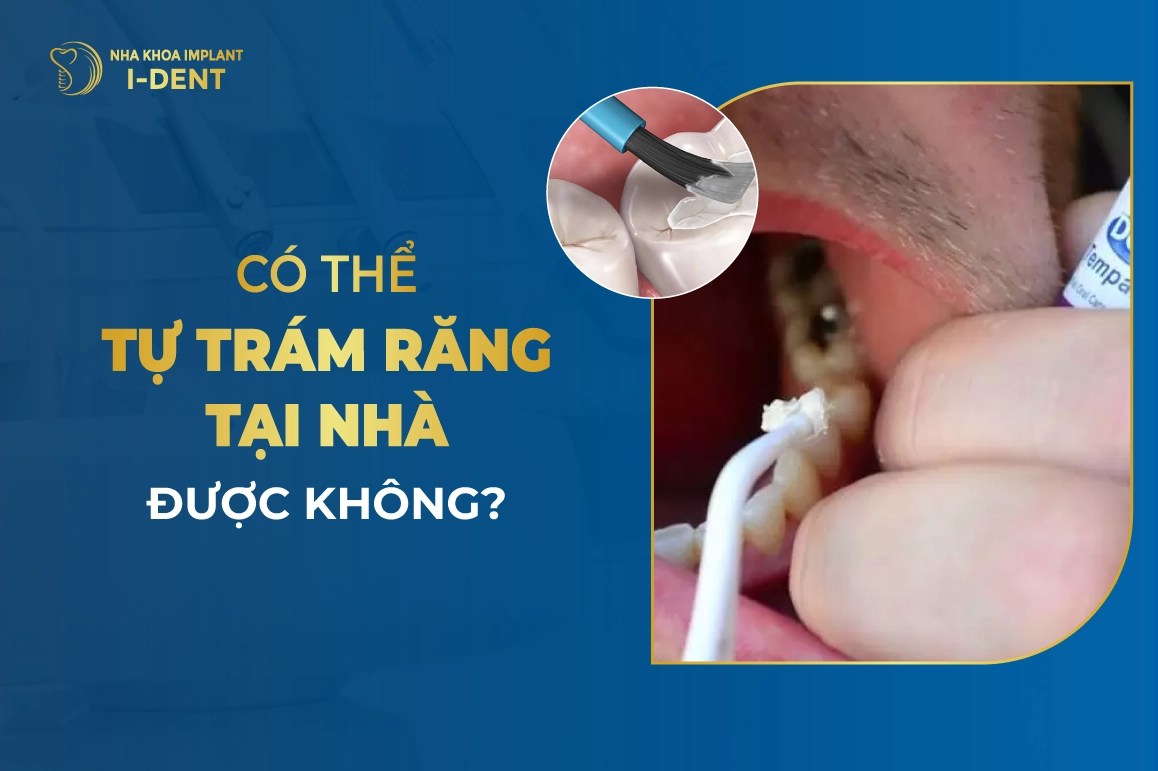 Co The Tu Tram Rang Tai Nha Duoc Khong