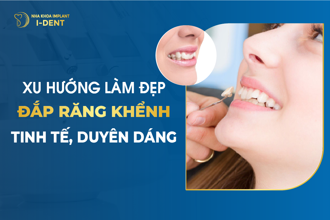 Dap Rang Khenh – Xu Huong Lam Dep Tinh Te Duyen Dang