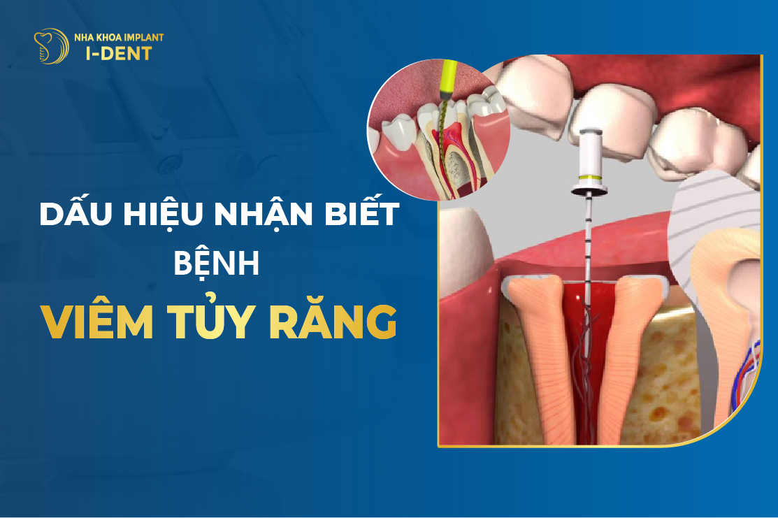 Dau Hieu Nhan Biet Benh Viem Tuy Rang