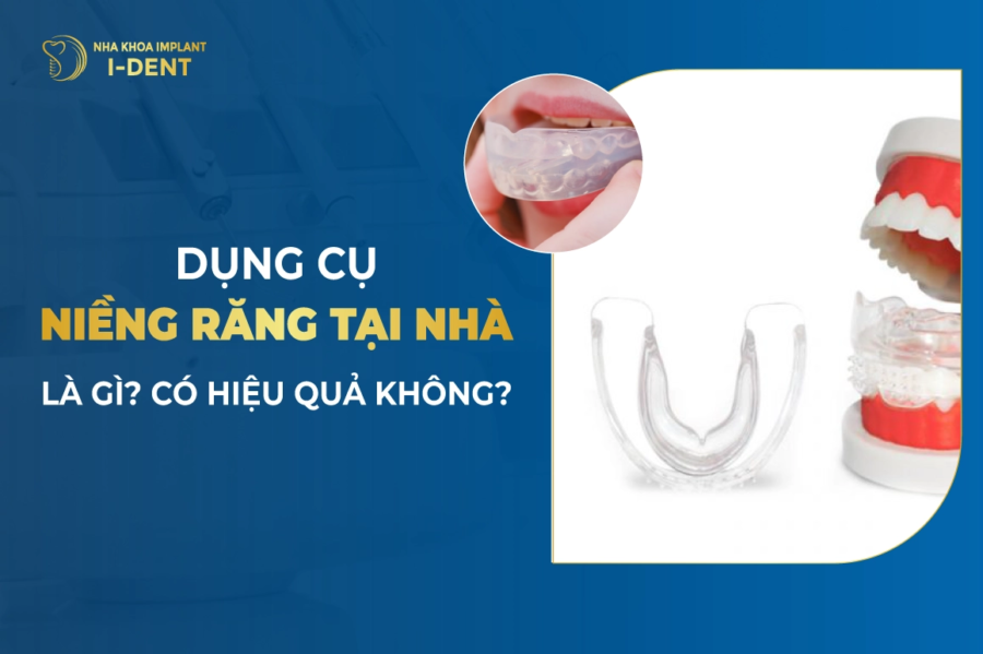 Dung Cu Nieng Rang Tai Nha La Gi Co Hieu Qua Khong Thumb E1762569543828