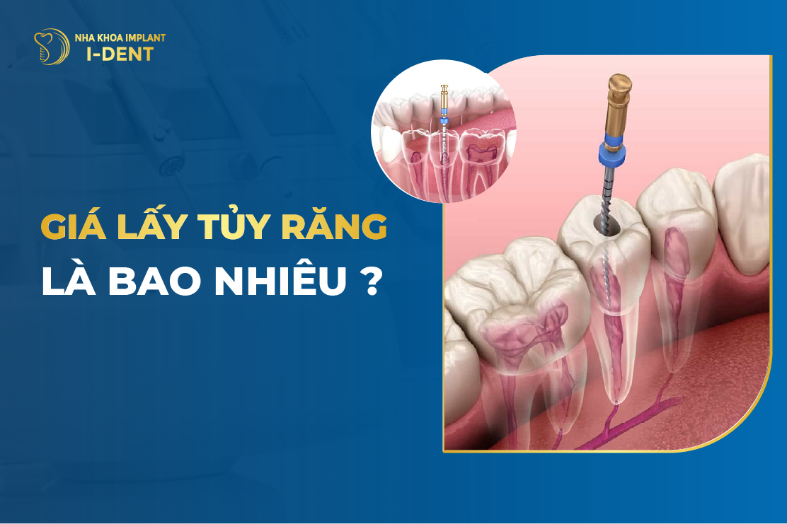 Gia Lay Tuy Rang La Bao Nhieu