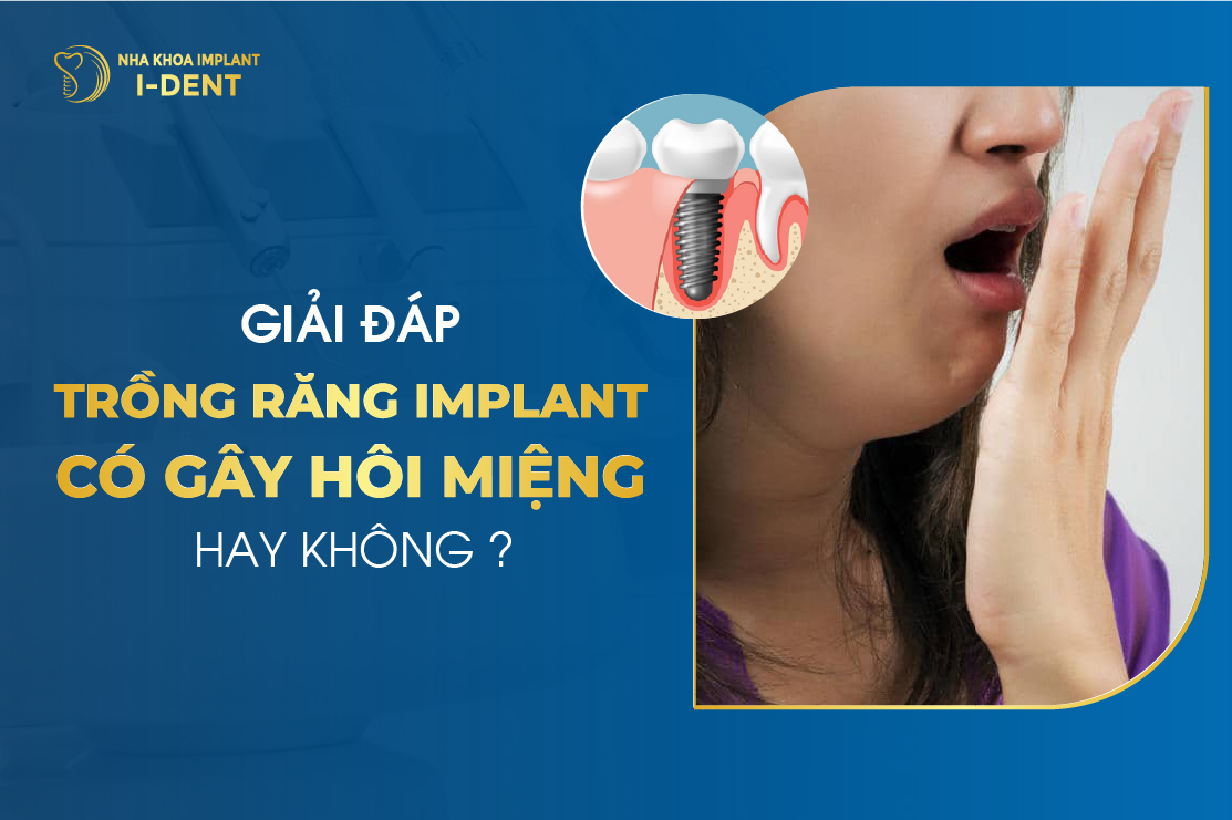 Giai Dap Trong Rang Implant Co Gay Hoi Mieng Hay Khong