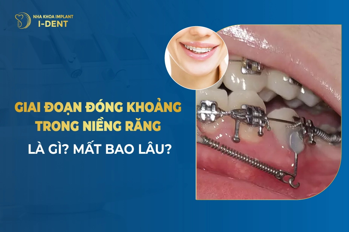 Giai Doan Dong Khoang Trong Nieng Rang La Gi Mat Bao Lau