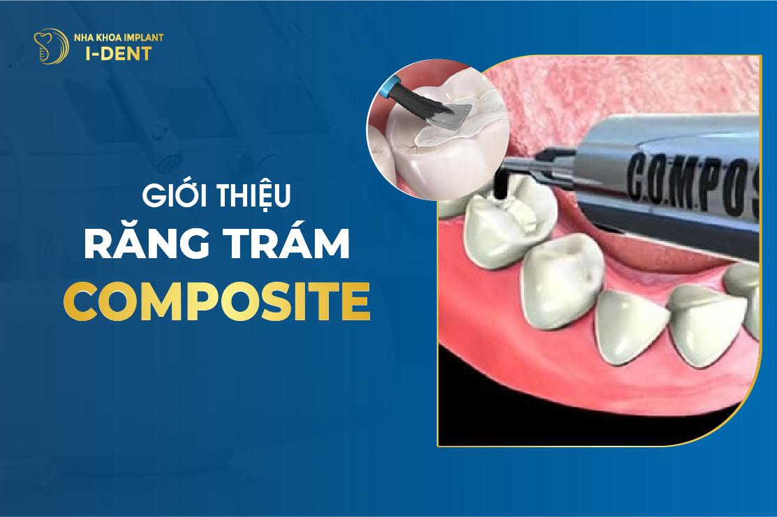 Gioi Thieu Rang Tram Composite